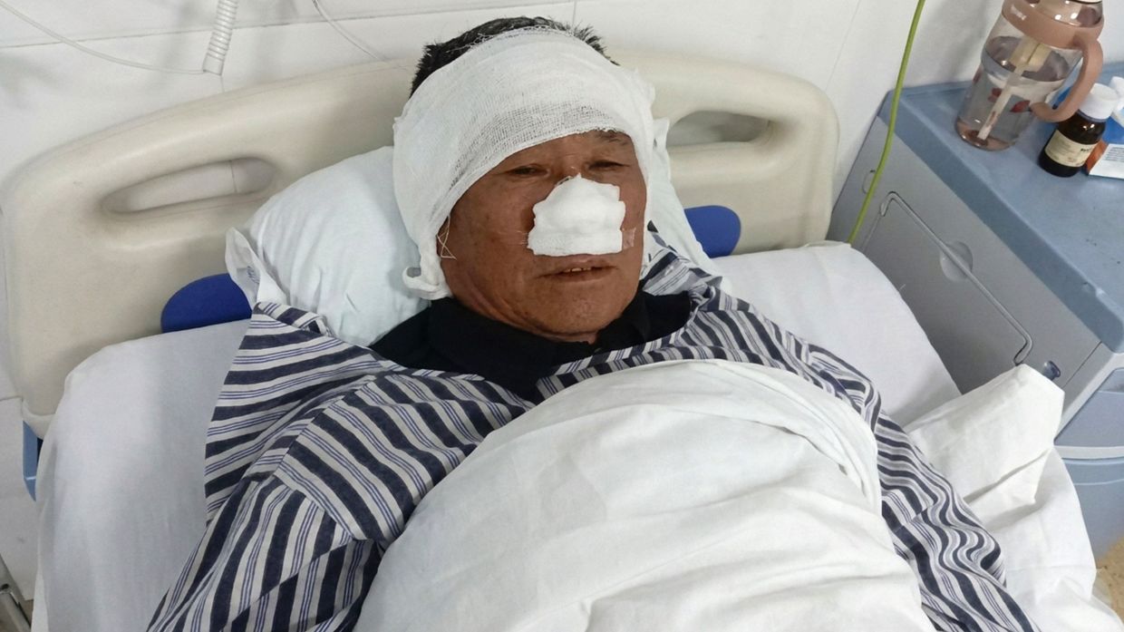 Chinese villager loses nose saving woman from attacker, awarded national hero status