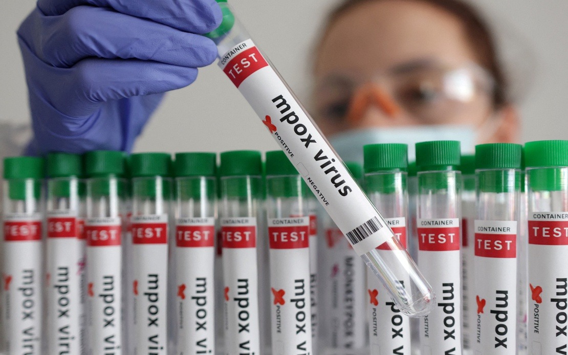 Guinea-Bissau Confirms First Mpox Case as Health Authorities Mobilise Response