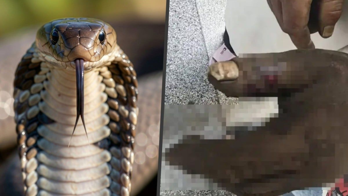 Chinese woman poisons herself trying to save husband from cobra bite using TV-inspired method