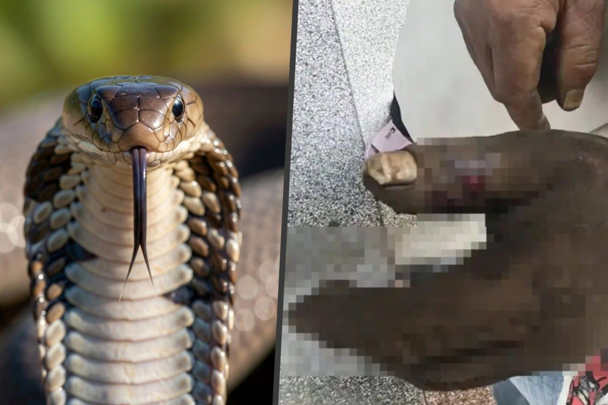 Chinese woman poisons herself trying to save husband from cobra bite using TV-inspired method