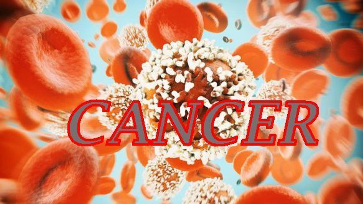 The Rising Threat of Colorectal Cancer in Young People