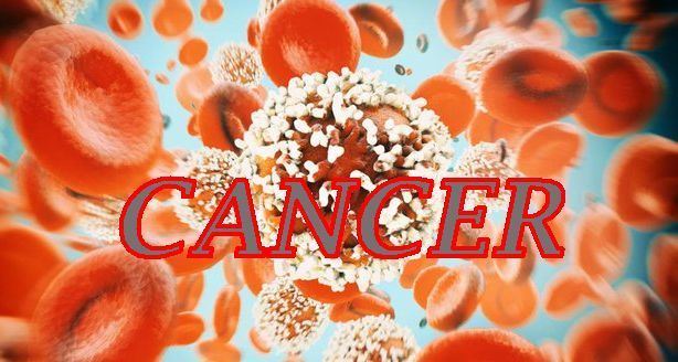 The Rising Threat of Colorectal Cancer in Young People