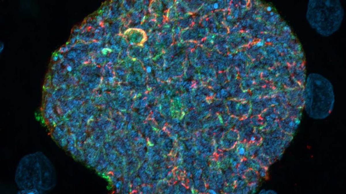 Australian Researchers Turn Mosquito Bites Into Malaria Immunity Boosters
