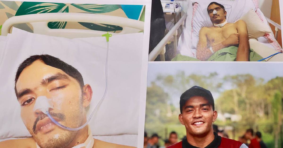 Malaysian Army Concludes Probe into Johor Camp Commando Injury; Dismissals Under Way