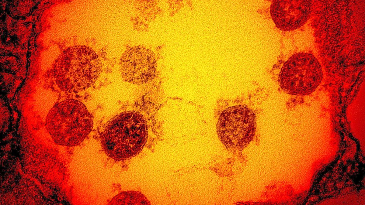Cambridge Scientists Develop 'Master Key' Vaccine Technology to Combat Multiple Virus Families