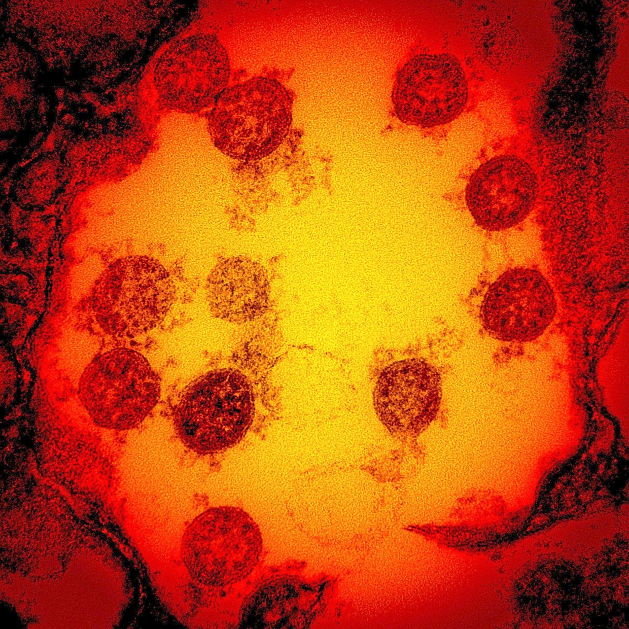 Cambridge Scientists Develop 'Master Key' Vaccine Technology to Combat Multiple Virus Families